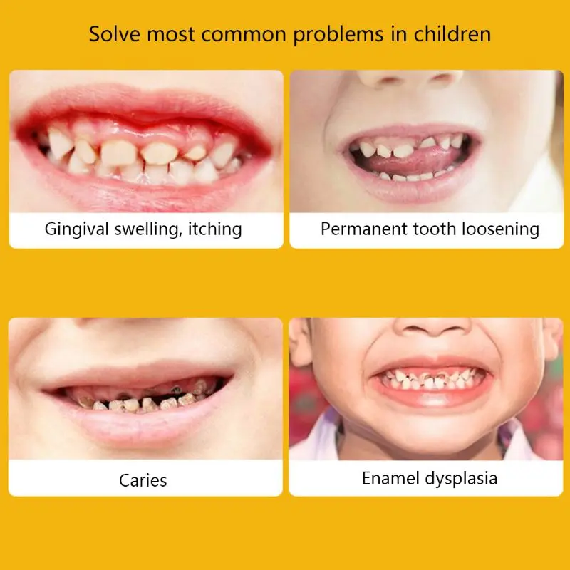 Soft Cute Cartoon Toothbrush Baby Teeth Toothbrushes Dental Oral Care for Children Kids Dental White Teeth Whitening
Soft Cute Cartoon Toothbrush Baby Teeth Toothbrushes Dental Oral Care for Children Kids Dental White Teeth Whitening