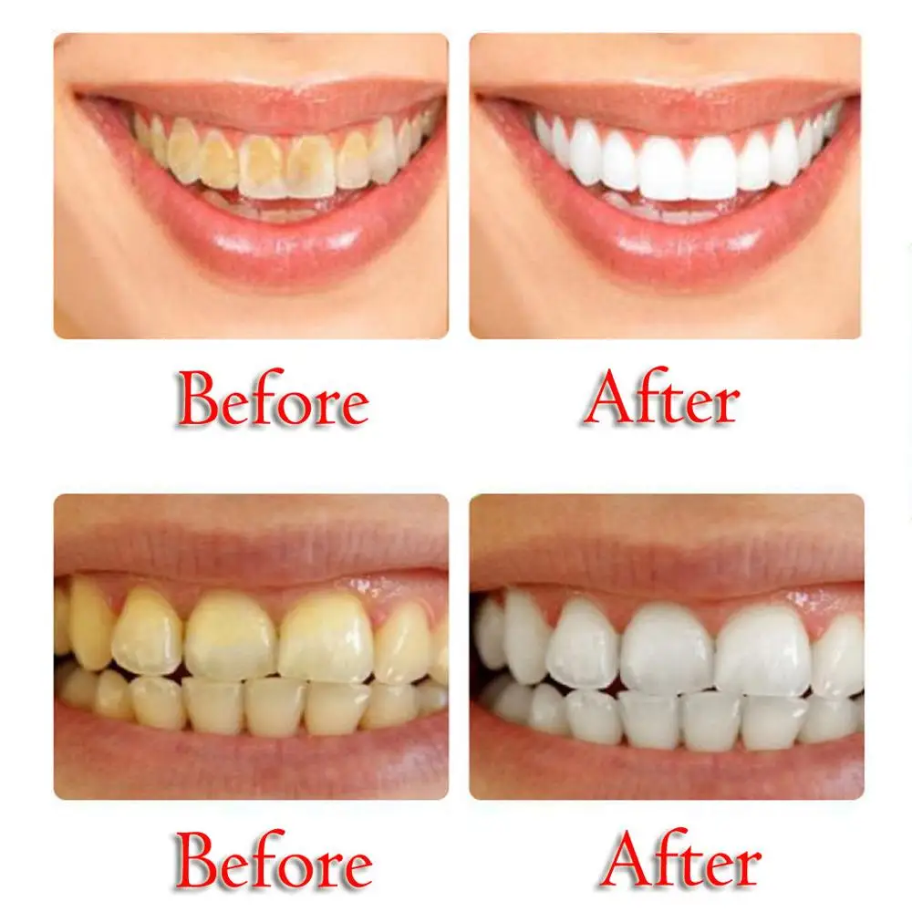 220g Herb Natural Herbal Clove Tooth Intensive Stain Removal Whitening Toothpaste Fight Bleeding Gums Toothpaste Fashion Tools
220g Herb Natural Herbal Clove Tooth Intensive Stain Removal Whitening Toothpaste Fight Bleeding Gums Toothpaste Fashion Tools