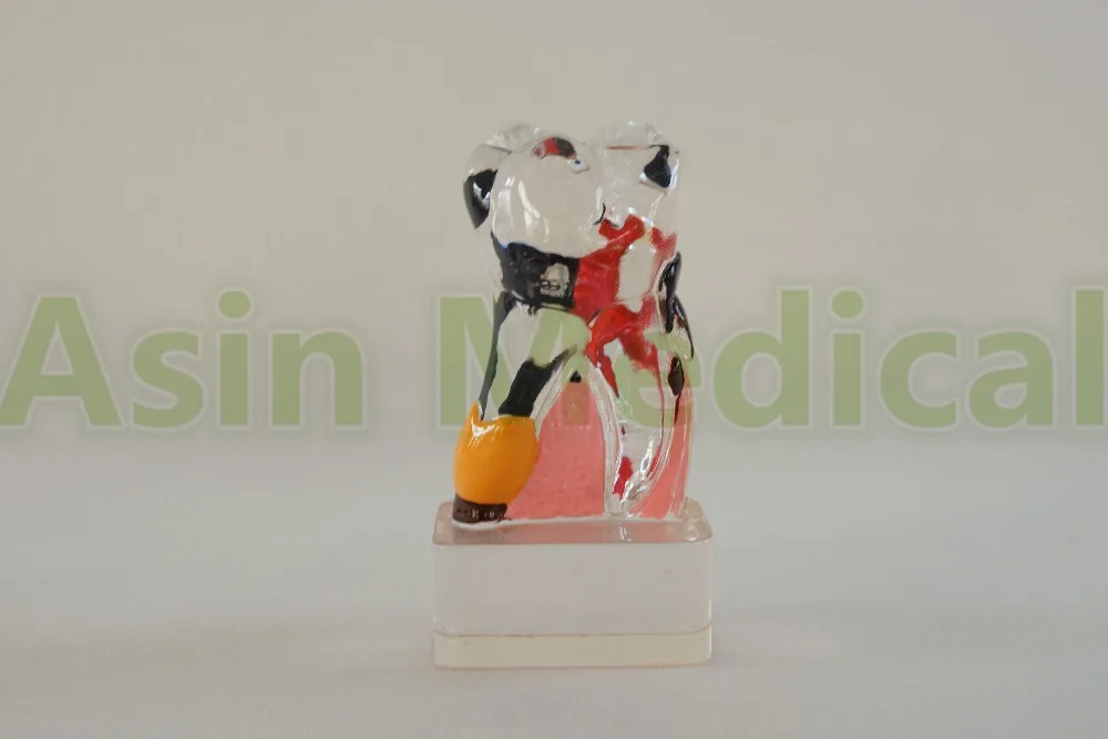 DEASIN New Arrival Dental Teeth Model 4 Times Periodontal Disease Assort Tooth Classification Model
DEASIN New Arrival Dental Teeth Model 4 Times Periodontal Disease Assort Tooth Classification Model