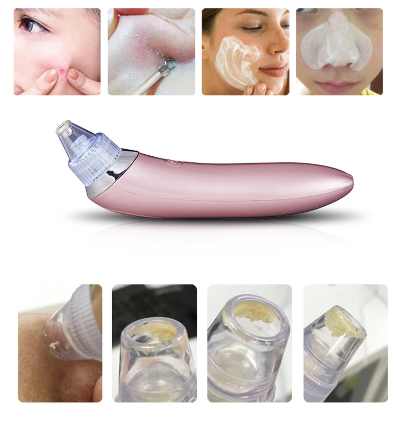 EFERO Blackhead Remover Skin Care Face Deep Pore Acne Pimple Removal Vacuum Suction Face Diamond Beauty Tool Machine
EFERO Blackhead Remover Skin Care Face Deep Pore Acne Pimple Removal Vacuum Suction Face Diamond Beauty Tool Machine