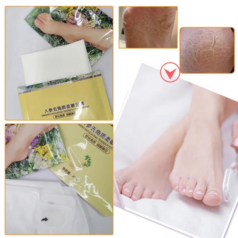 1 Pair Foot Pad Health Chinese Foot Pads Peel Feet Exfoliating Foot Masks Ginseng Extract Hard Dead Skin Remover Feet Mask
1 Pair Foot Pad Health Chinese Foot Pads Peel Feet Exfoliating Foot Masks Ginseng Extract Hard Dead Skin Remover Feet Mask
