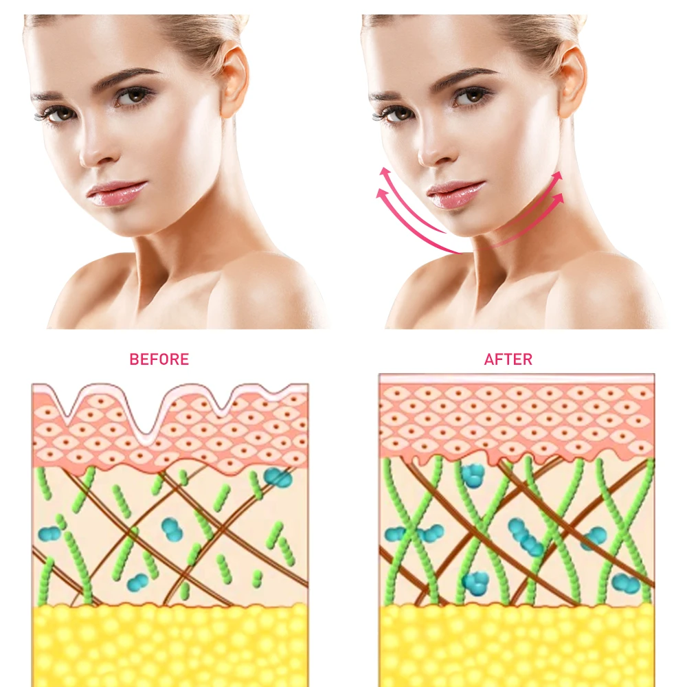 Rechargeable Face Lift Machine Multifunction Beauty Device Skin Tightening Facial Wrinkle Blackhead Remover Face Massage Device
Rechargeable Face Lift Machine Multifunction Beauty Device Skin Tightening Facial Wrinkle Blackhead Remover Face Massage Device
