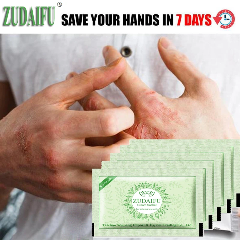14PCS/Lot zudaifu Small package sample installation Body Psoriasis Cream Dermatitis and Eczema Pruritus Psoriasis Ointment
14PCS/Lot zudaifu Small package sample installation Body Psoriasis Cream Dermatitis and Eczema Pruritus Psoriasis Ointment