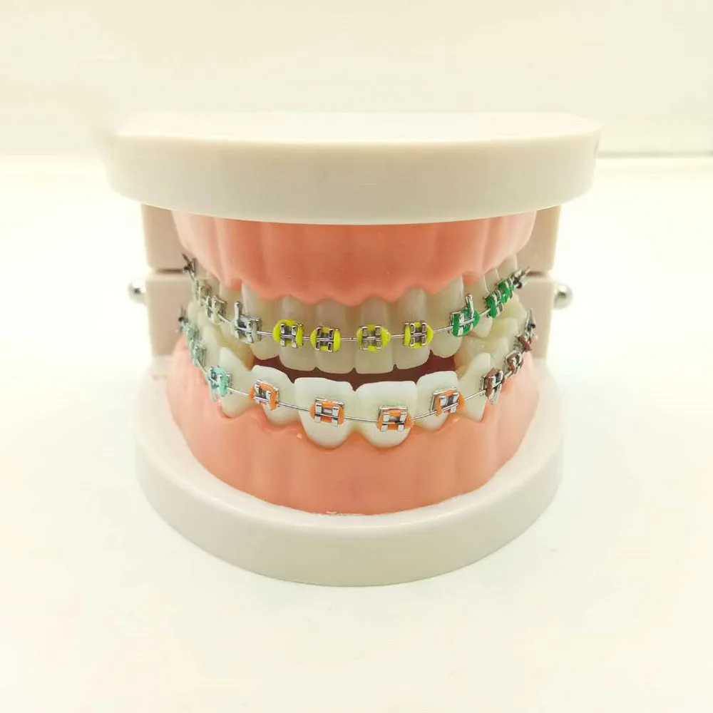 Dental Orthodontic Treatment Model With Ortho Metal Ceramic Bracket Arch Wire Buccal Tube Ligature Ties
Dental Orthodontic Treatment Model With Ortho Metal Ceramic Bracket Arch Wire Buccal Tube Ligature Ties