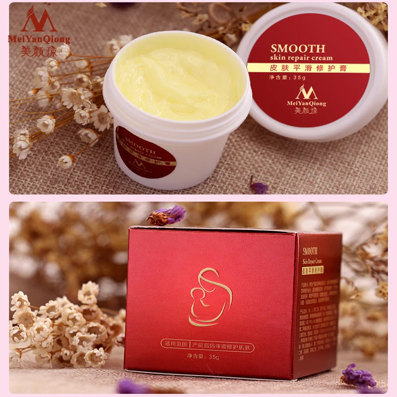 2pcs Smooth Skin Stretch Mark Skin Cream Removes Maternal Skin Repair Body Cream Removes Postpartum ScarCare Gentle Moisturizing
2pcs Smooth Skin Stretch Mark Skin Cream Removes Maternal Skin Repair Body Cream Removes Postpartum ScarCare Gentle Moisturizing