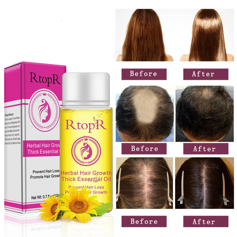 RtopR New Hair Growth Essential Oil 20ml Herbal Fast Hair Growth Longer Thick Essence Professional Anti-hair loss Products
RtopR New Hair Growth Essential Oil 20ml Herbal Fast Hair Growth Longer Thick Essence Professional Anti-hair loss Products