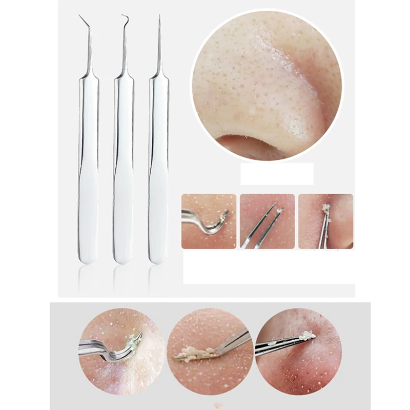 8Pcs Professional Blackhead Acne Comedone Pimple Blemish Extractor Beauty Tool With Bag Stainless Steel Blackhead Remover Kit
8Pcs Professional Blackhead Acne Comedone Pimple Blemish Extractor Beauty Tool With Bag Stainless Steel Blackhead Remover Kit