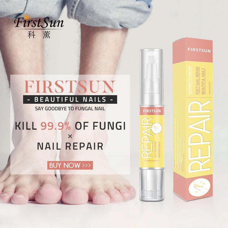 Herbal Nail Nourishment Pen Revitalizer Remover Cuticle Fungus Toe Fungal Nail Treatment Soften Repair Anti Fungal Infection
Herbal Nail Nourishment Pen Revitalizer Remover Cuticle Fungus Toe Fungal Nail Treatment Soften Repair Anti Fungal Infection