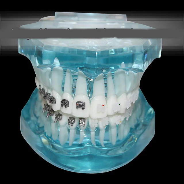 Dental Orthodontic model self-ligating bracket straight wire edgewise bracket four kinds of ceramic brackets comparison model
Dental Orthodontic model self-ligating bracket straight wire edgewise bracket four kinds of ceramic brackets comparison model