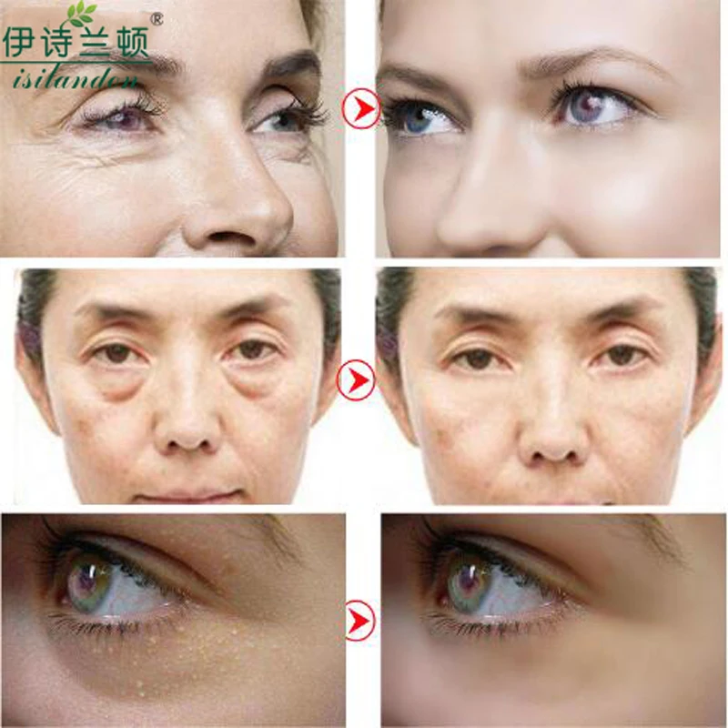 ISILANDON Hyaluronic Acid Golden Eye Mask Sleep Mask Eye Patches Dark Circles Mask Facial To Face Skin Care Anti Wrinkle 60pcs
ISILANDON Hyaluronic Acid Golden Eye Mask Sleep Mask Eye Patches Dark Circles Mask Facial To Face Skin Care Anti Wrinkle 60pcs