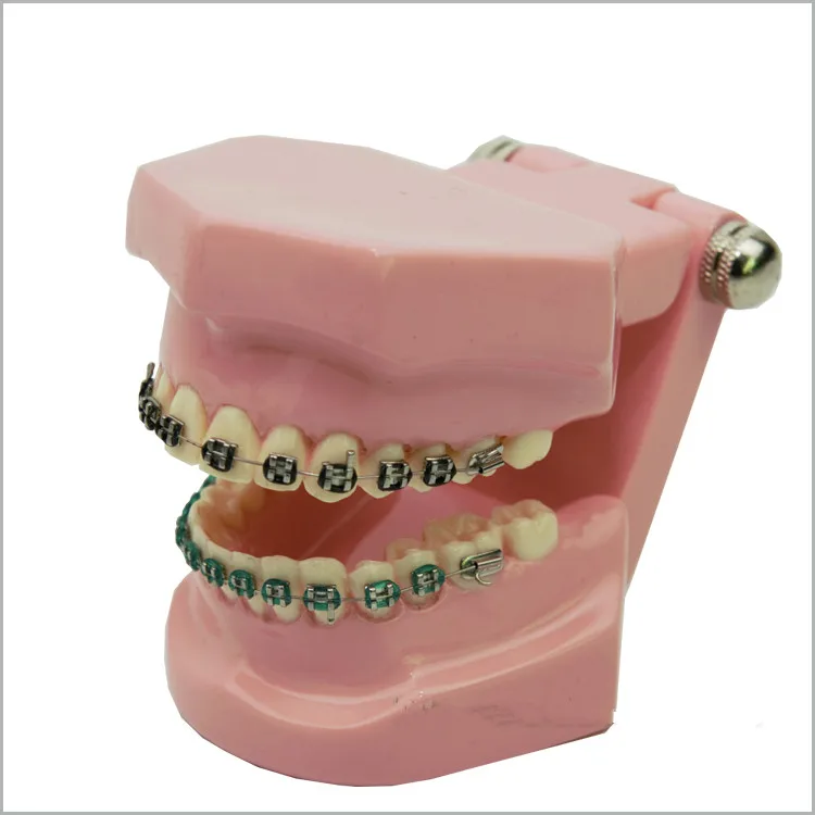 Good Quality 2016 New Arrival Orthodontic correction model Dental Teaching model free shipping
Good Quality 2016 New Arrival Orthodontic correction model Dental Teaching model free shipping
