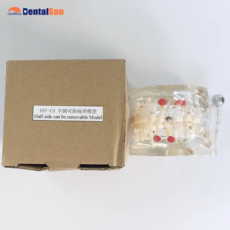 Dental Orthodontic Model/Half Side Can be Temovable Orthodontic Teeth Model HST-C3
Dental Orthodontic Model/Half Side Can be Temovable Orthodontic Teeth Model HST-C3