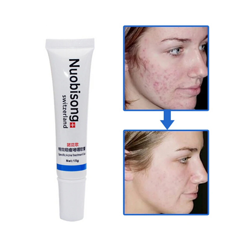 100pcs/lot Nuobisong face care specific acne cream skin care treatment whitening face cream moisturizing cream
100pcs/lot Nuobisong face care specific acne cream skin care treatment whitening face cream moisturizing cream