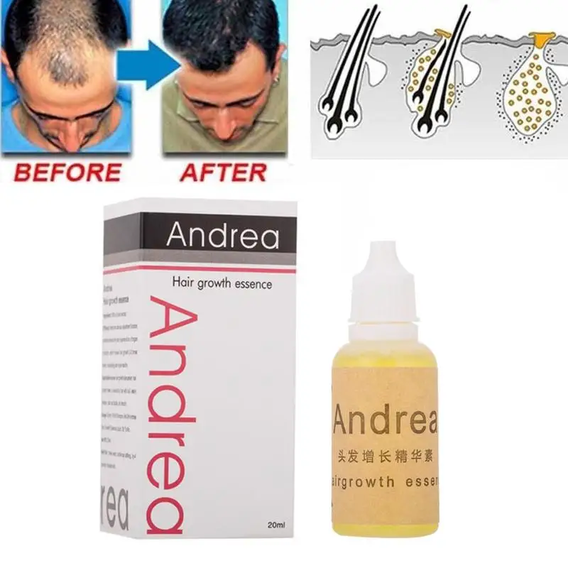 20ml Andrea Hair Growth Loss Essential Oils Liquid Dense Huile Essentielle Fast Sunburst Grow Restoration Pilatory
20ml Andrea Hair Growth Loss Essential Oils Liquid Dense Huile Essentielle Fast Sunburst Grow Restoration Pilatory