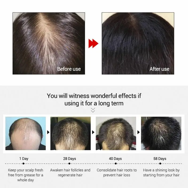 Сыворотка для роста волос 10 шт. | Красота и здоровье