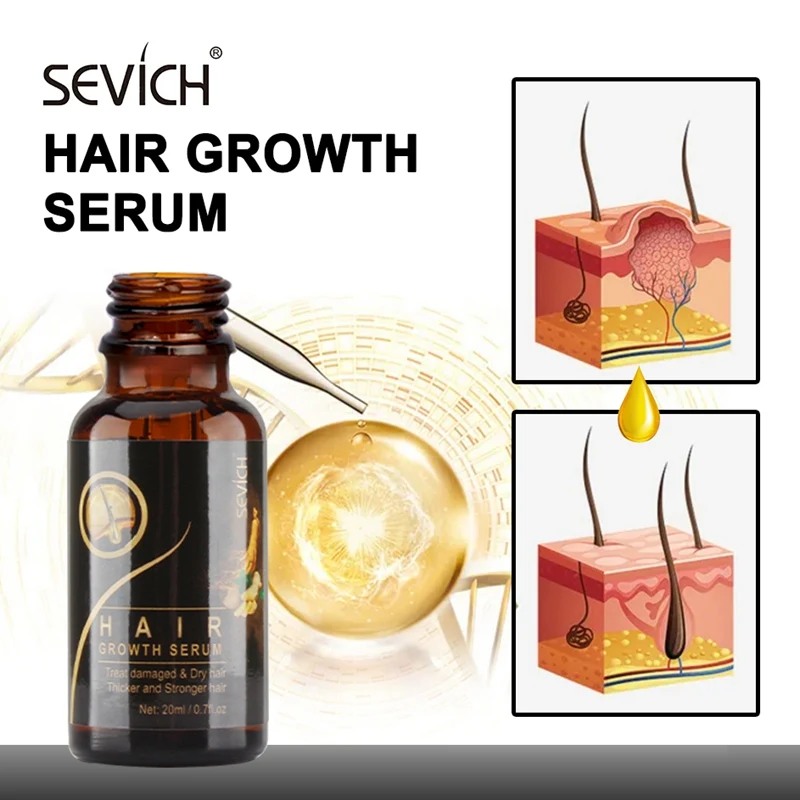 

Sevich Ginger Hair Oil Hair Regrowth Treatment 20ml Control Repairing Anti Loss Regrowth Scalp Elixirs Hair Growth Oil Serum
