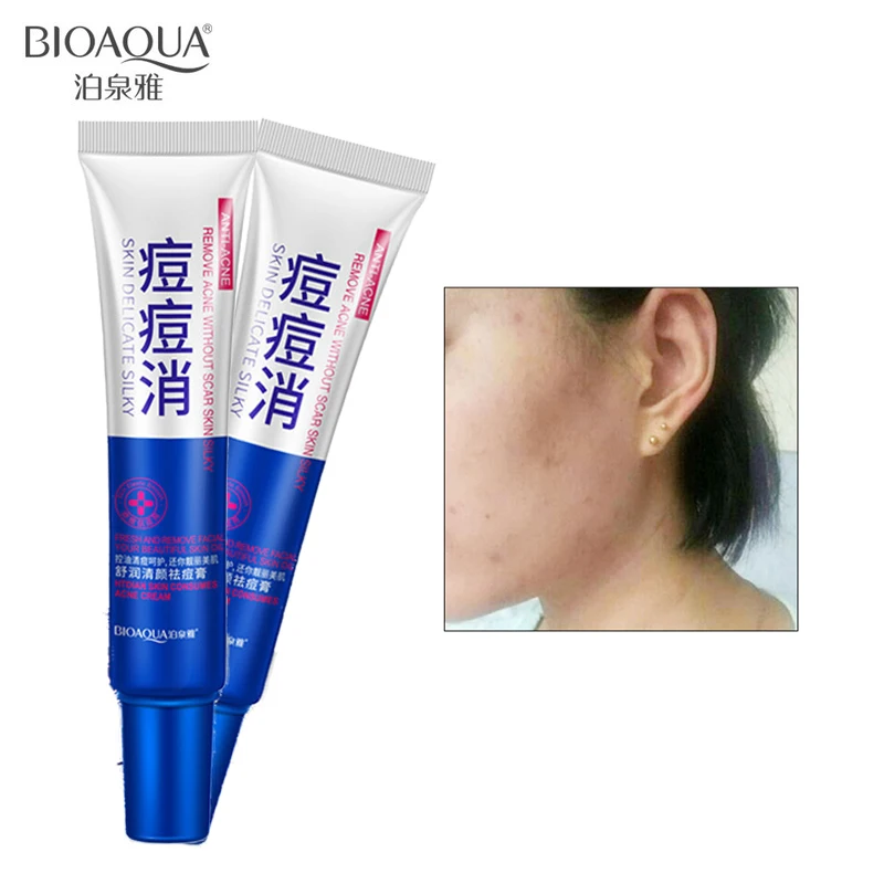 BIOAQUA Acne Treatment Skin Care Acne Cleaning Cream Remove Repair Comedone Pimple Acne Quickly Face Acne Cream Remover Anti
BIOAQUA Acne Treatment Skin Care Acne Cleaning Cream Remove Repair Comedone Pimple Acne Quickly Face Acne Cream Remover Anti