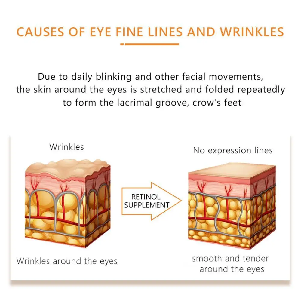Retinol Eye Serum Moisturizing Eye Massage Anti-aging Essence Firming Remover Dark Circles Wrinkle Anti-puffiness Bags eye Care
Retinol Eye Serum Moisturizing Eye Massage Anti-aging Essence Firming Remover Dark Circles Wrinkle Anti-puffiness Bags eye Care