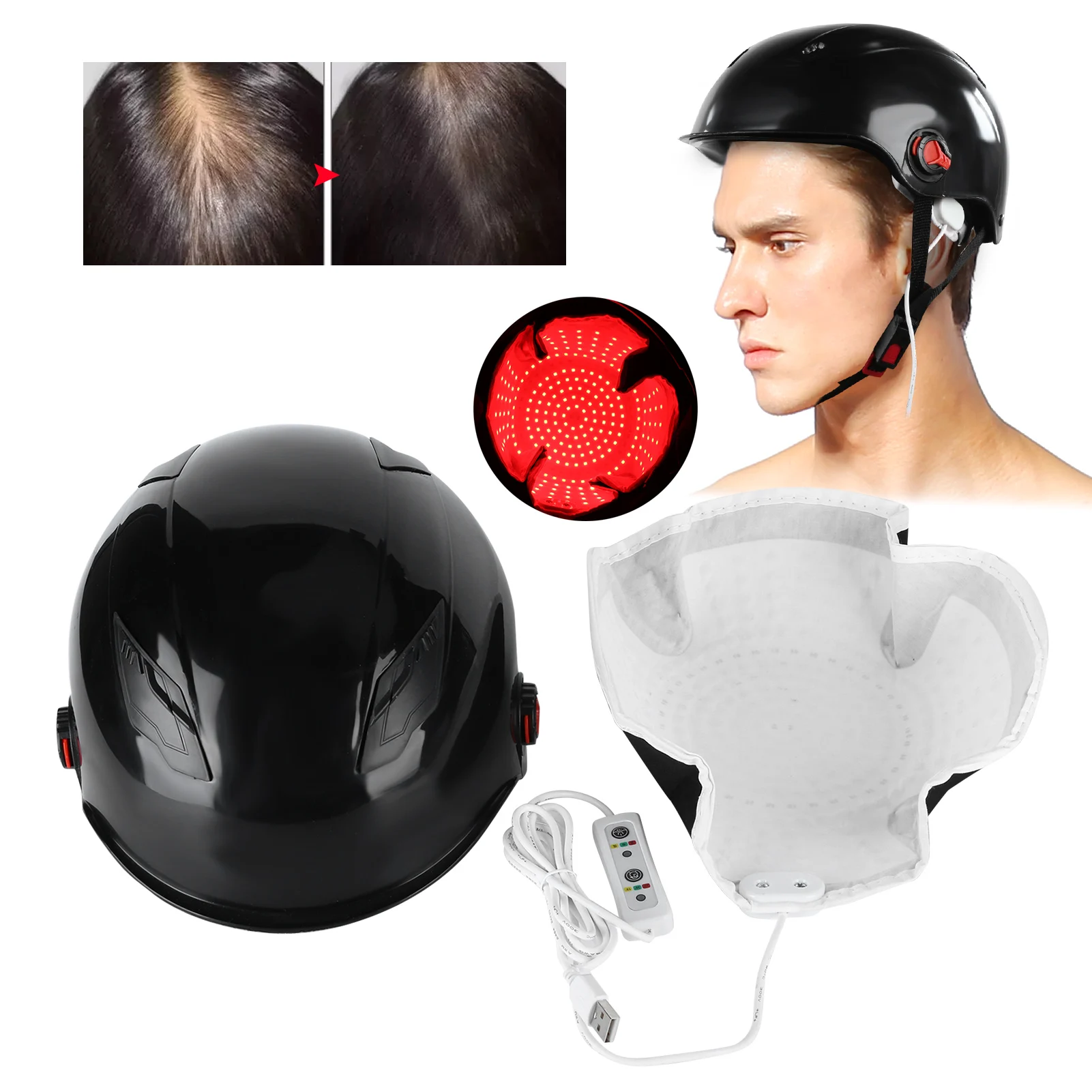 240/256/280pcs Lamp Beads Hair Growth Helmet Hair Loss Treatment Light Therapy Device Black
240/256/280pcs Lamp Beads Hair Growth Helmet Hair Loss Treatment Light Therapy Device Black