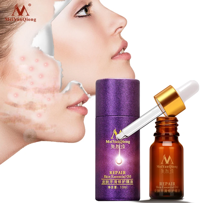 MeiYanQiong Smooth Skin Repair Essential Oil Acne Scar Removal Effectively Remove Scar Stretch Marks Acne Treatment Skin Care
MeiYanQiong Smooth Skin Repair Essential Oil Acne Scar Removal Effectively Remove Scar Stretch Marks Acne Treatment Skin Care
