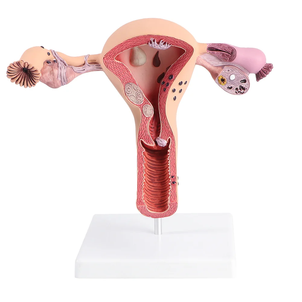 1Pc Practical Uterus Model Female Reproductive System Model for Training
1Pc Practical Uterus Model Female Reproductive System Model for Training