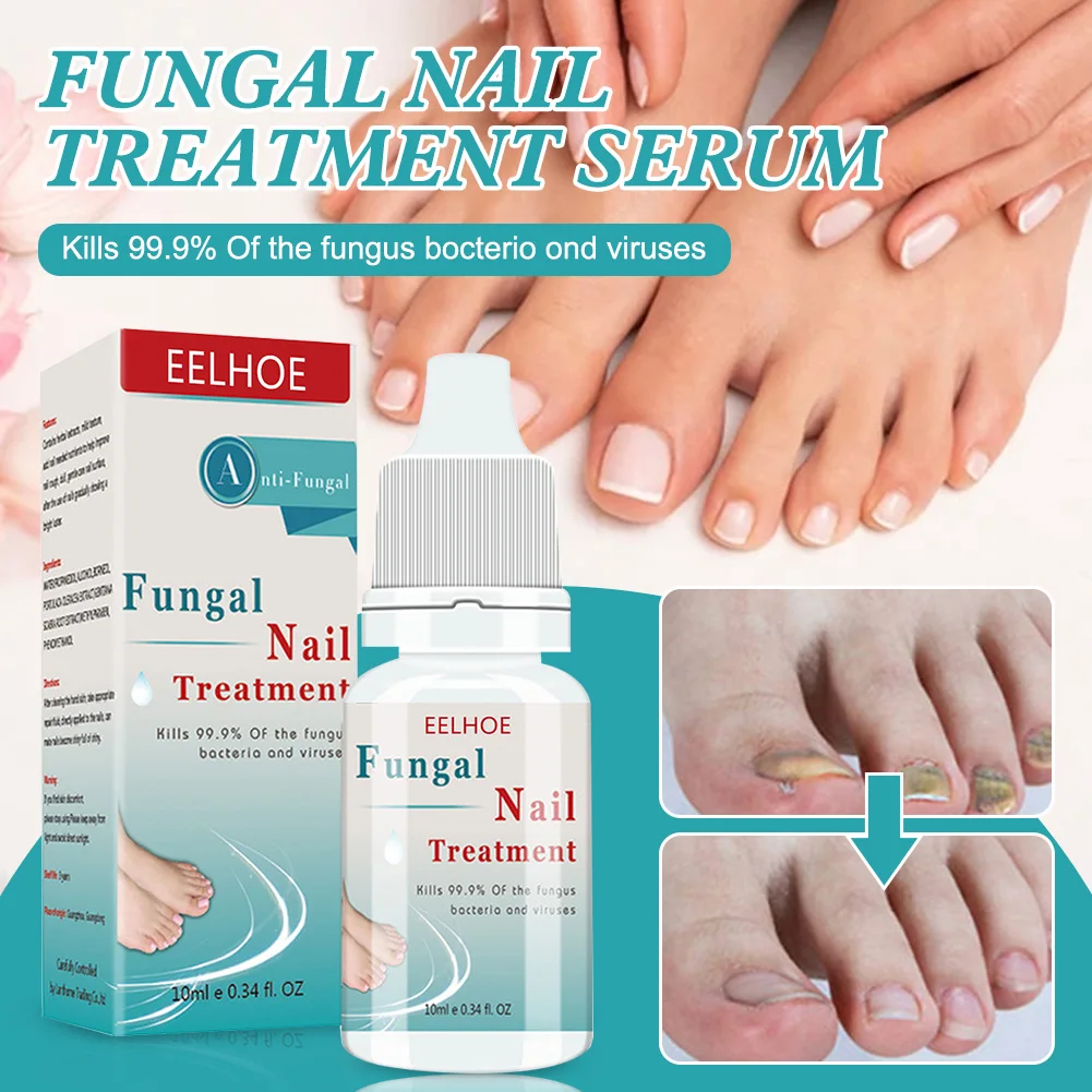 10ML Fungal Nail Treatment Serum for Toenails Fingernails Promote New Growth Repair onychomycosis Nail Fungus Repair Solution
10ML Fungal Nail Treatment Serum for Toenails Fingernails Promote New Growth Repair onychomycosis Nail Fungus Repair Solution