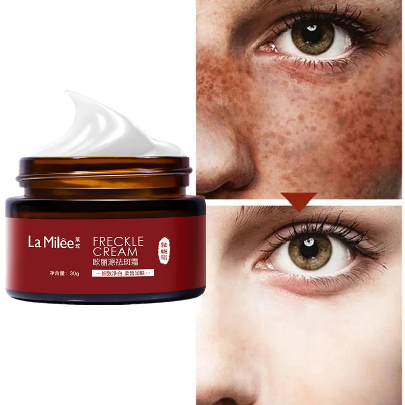 Freckle Whitening Cream To Remove Chloasma Cream, Dark Spots, Melanin, Chloasma Remover, Lighten The Skin, Anti-aging
Freckle Whitening Cream To Remove Chloasma Cream, Dark Spots, Melanin, Chloasma Remover, Lighten The Skin, Anti-aging