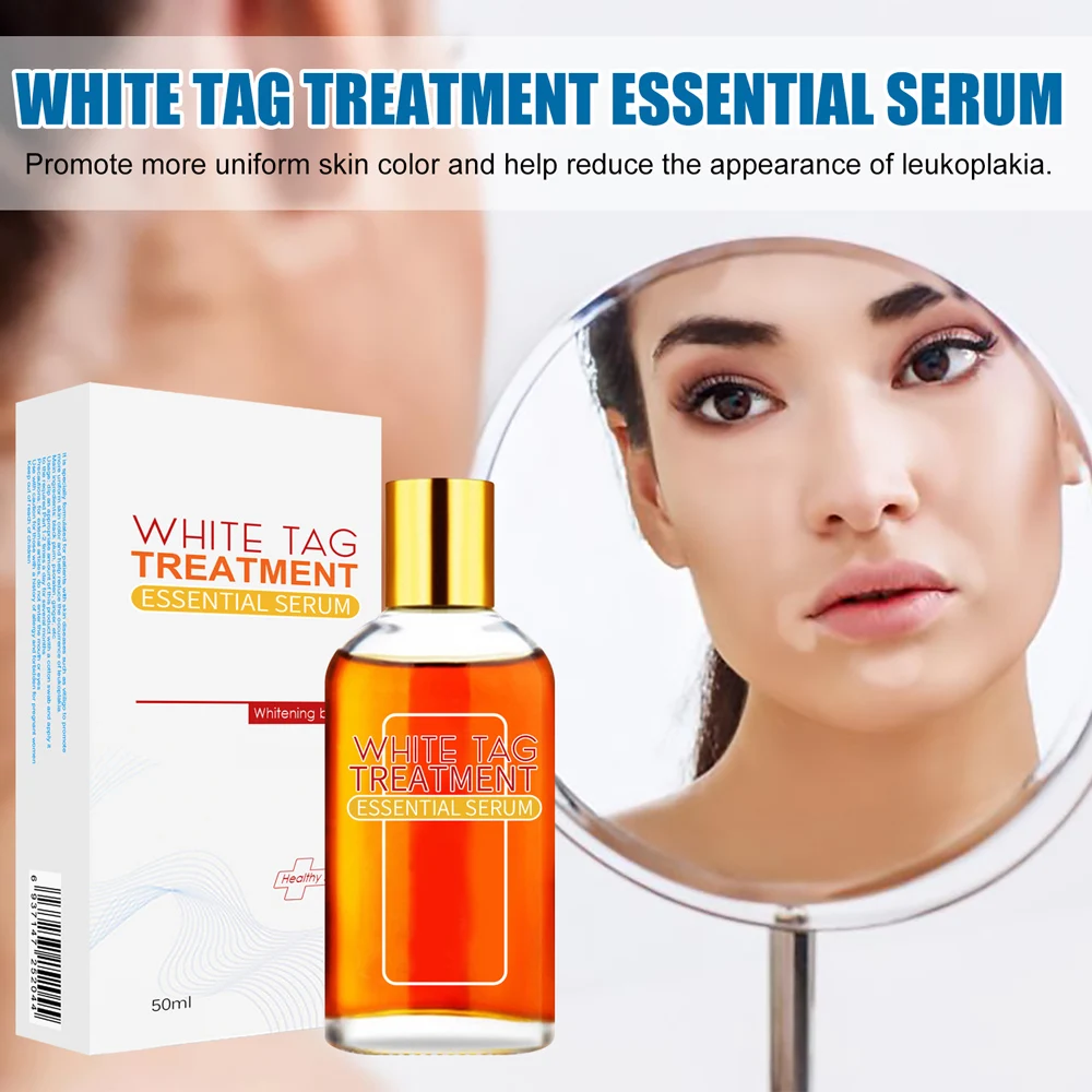 White Tag Treatment Essential Serum Psoralen White Spot Liquid Vitiligo Treatment Serum For All Skin Type SANA889
White Tag Treatment Essential Serum Psoralen White Spot Liquid Vitiligo Treatment Serum For All Skin Type SANA889