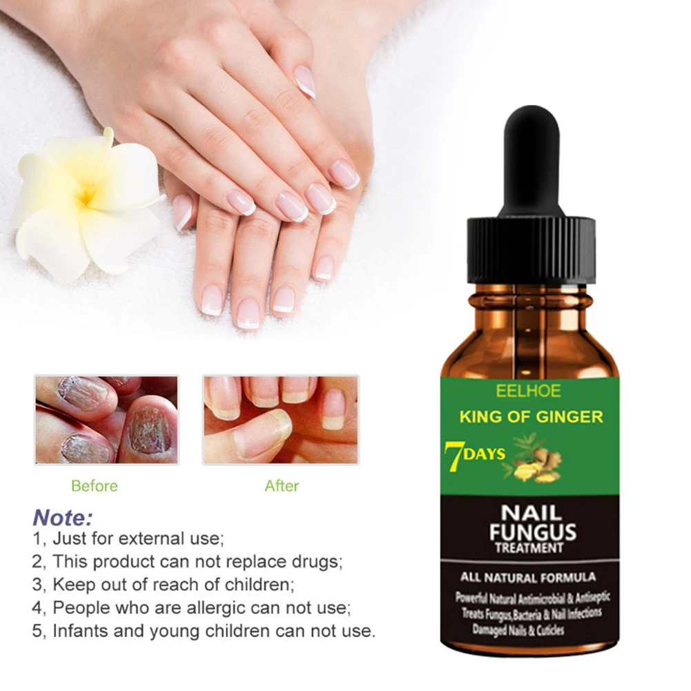 Nail Repair Liquid Removal Anti Onychomycosis Feet Care Treatment Fungal Nail Repair Liquid
Nail Repair Liquid Removal Anti Onychomycosis Feet Care Treatment Fungal Nail Repair Liquid