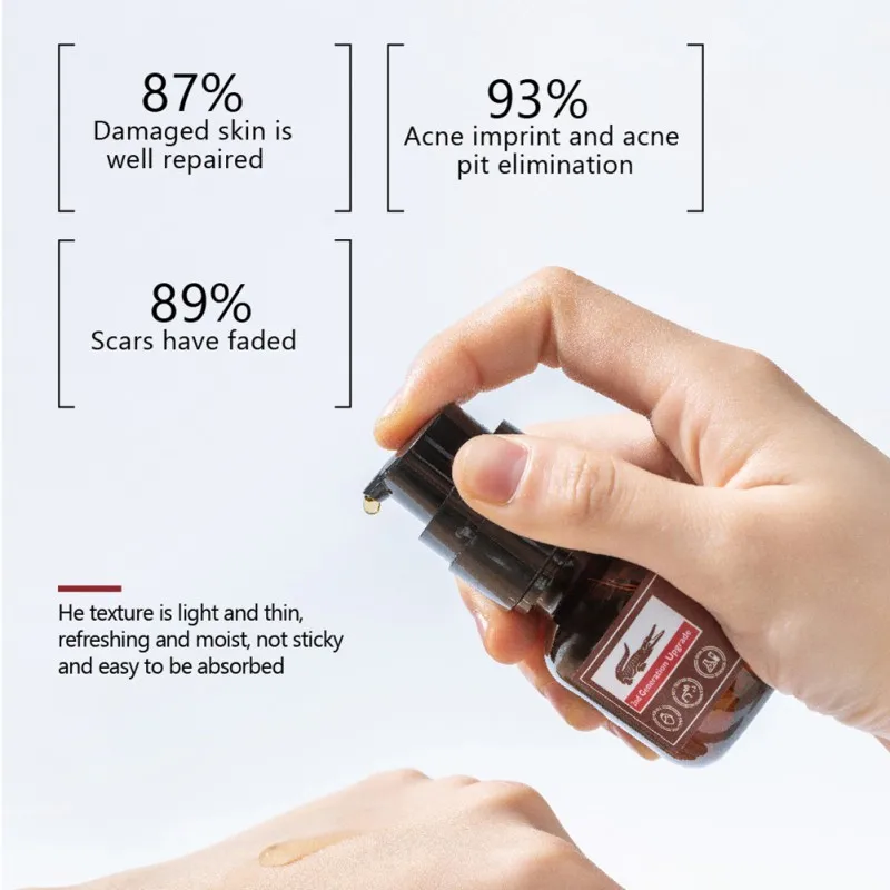 Removal Acne Scar Whitening Face Serum Spots Lighten Fine Lines Repair Scar Face Serum Anti Wrinkle Acne Treatment Essence
Removal Acne Scar Whitening Face Serum Spots Lighten Fine Lines Repair Scar Face Serum Anti Wrinkle Acne Treatment Essence