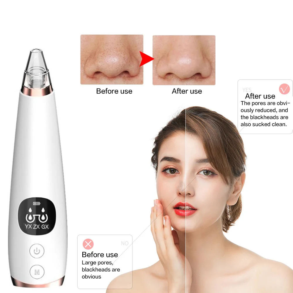 Electric Blackhead Remover Facial Pore Acne Cleaner Machine Black Head Remover Point Vacuum Removal Skin Care Tools Beauty 
Electric Blackhead Remover Facial Pore Acne Cleaner Machine Black Head Remover Point Vacuum Removal Skin Care Tools Beauty