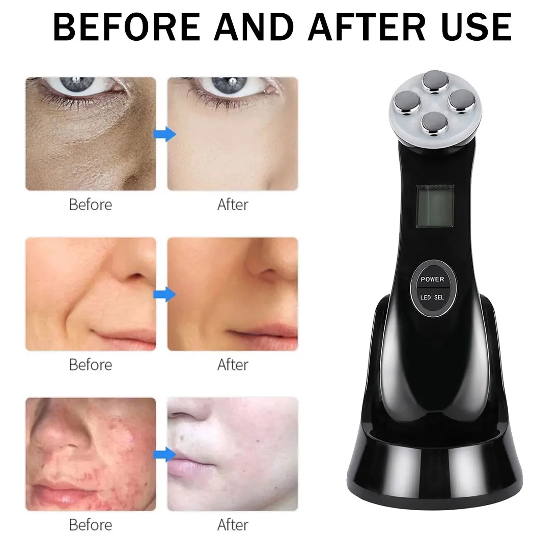 Face Massager EMS Mesotherapy Electroporation RF Radio Frequency LED Photon Face Wrinkle Remover Gel Skin Care Rejuvenation
Face Massager EMS Mesotherapy Electroporation RF Radio Frequency LED Photon Face Wrinkle Remover Gel Skin Care Rejuvenation