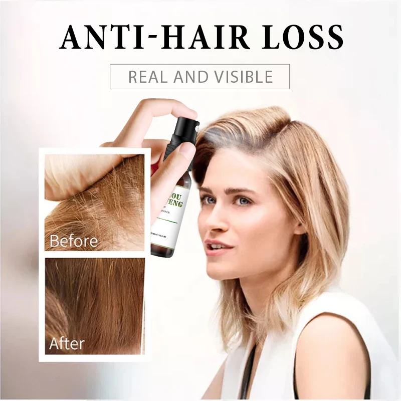 Hair Growth Essence Oil Spray Fast Grow Hair Oil hair loss Treatment For Thinning Hair Products Hair Care for Men Women
Hair Growth Essence Oil Spray Fast Grow Hair Oil hair loss Treatment For Thinning Hair Products Hair Care for Men Women