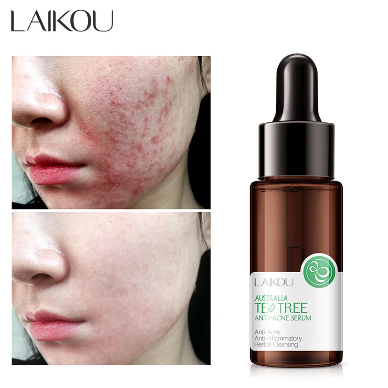 LAIKOU Tea tree essence Face Serum Anti-Aging Wrinkles Exfoliating Shrink Pores Anti-Oxidation Lift Firming Remove Fine Lines17g
LAIKOU Tea tree essence Face Serum Anti-Aging Wrinkles Exfoliating Shrink Pores Anti-Oxidation Lift Firming Remove Fine Lines17g