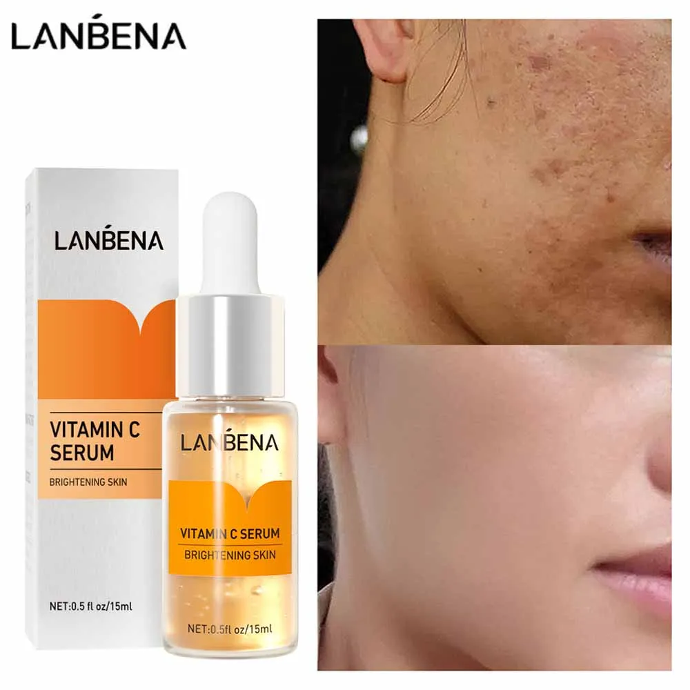 LANBENA Vitamin C Whitening Freckle Serum Cosmetics Hyaluronic Acid Moisturizing Brighten Fade Spots Skin Care Beauty Products
LANBENA Vitamin C Whitening Freckle Serum Cosmetics Hyaluronic Acid Moisturizing Brighten Fade Spots Skin Care Beauty Products
