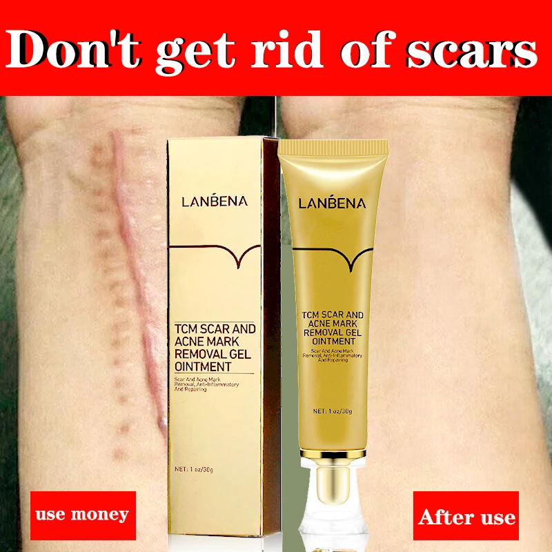 30g Scar Removal Cream to remove bump scar scar repair cream scar removal cream for old scars
30g Scar Removal Cream to remove bump scar scar repair cream scar removal cream for old scars