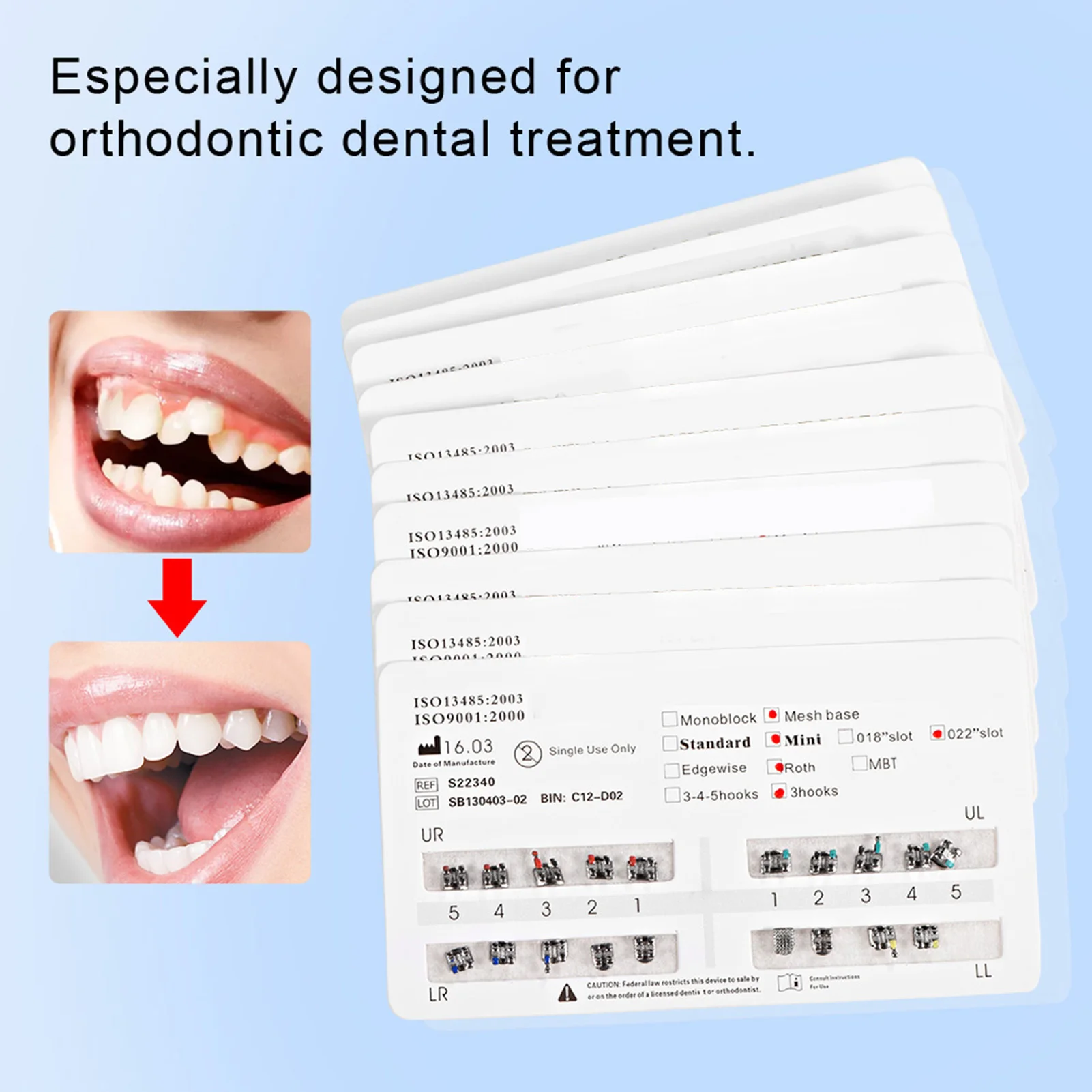10 Packs High-quality Metal Dental Teeth Orthodontics Brackets Braces Mini Roth 022 Hooks 3-4-5 Mini Straight Wire Brackets Tool
10 Packs High-quality Metal Dental Teeth Orthodontics Brackets Braces Mini Roth 022 Hooks 3-4-5 Mini Straight Wire Brackets Tool