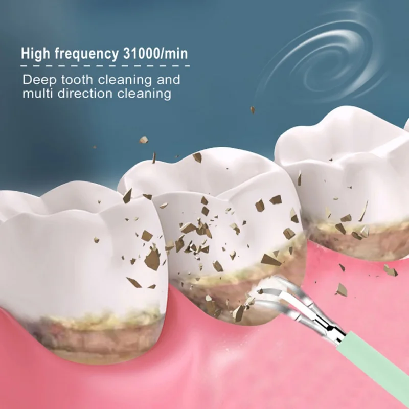 Electric Tartar Remover Teeth Whitening Cleaning Dental Tartar Scraper Tooth Polisher Stain Eraser High Frequency Vibration
Electric Tartar Remover Teeth Whitening Cleaning Dental Tartar Scraper Tooth Polisher Stain Eraser High Frequency Vibration