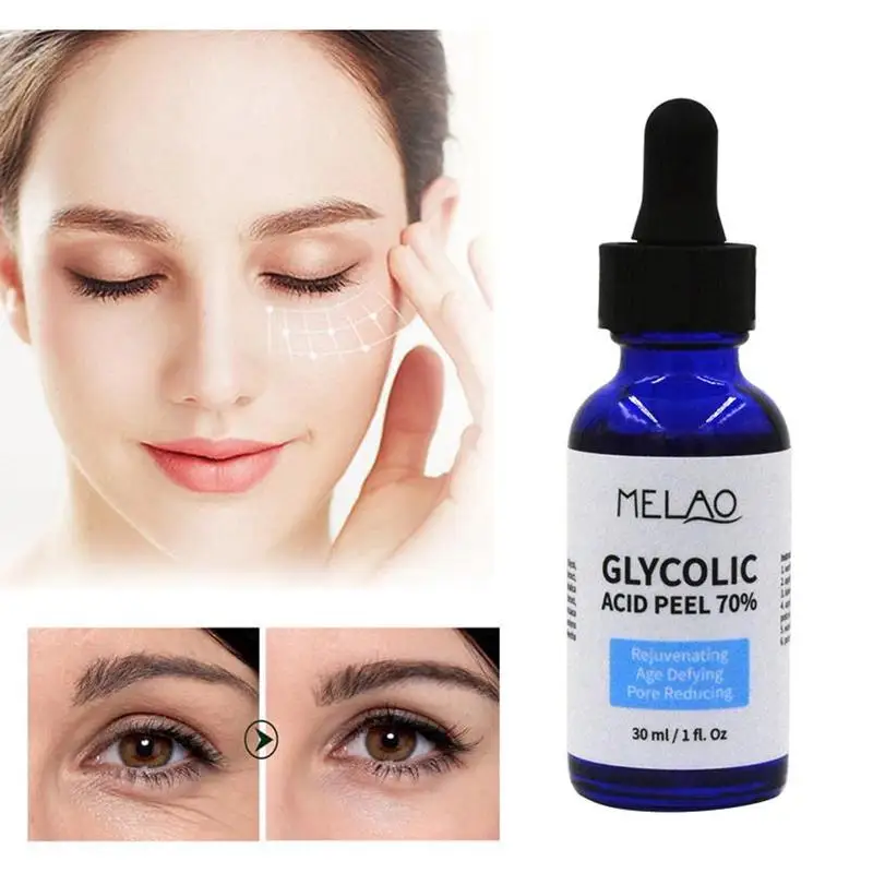 30ml Glycolic Acid Peel 70% Serum Repair Skin Care Shrink Pores Brighten Acne Treatment Face Serum Moisturizing
30ml Glycolic Acid Peel 70% Serum Repair Skin Care Shrink Pores Brighten Acne Treatment Face Serum Moisturizing