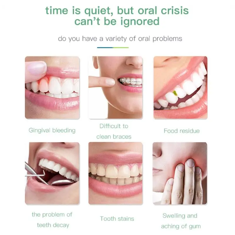 300ML Water Tank Oral Irrigator USB Rechargeable Water Flosser Portable Waterproof Dental Teeth Water Jet Spray Device U1JE
300ML Water Tank Oral Irrigator USB Rechargeable Water Flosser Portable Waterproof Dental Teeth Water Jet Spray Device U1JE