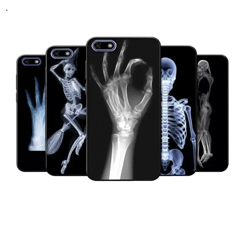 X-ray Hand Bones Phone Case For Xiaomi Mi6 Mi8 Mi9 Mi10 F1 X Se Lite Pro Note Mix 2 3 10 Cover
X-ray Hand Bones Phone Case For Xiaomi Mi6 Mi8 Mi9 Mi10 F1 X Se Lite Pro Note Mix 2 3 10 Cover