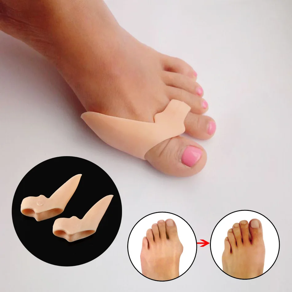 Hallux valgus orthosis toe appliance silicone insole toe toe separator toe separator
Hallux valgus orthosis toe appliance silicone insole toe toe separator toe separator