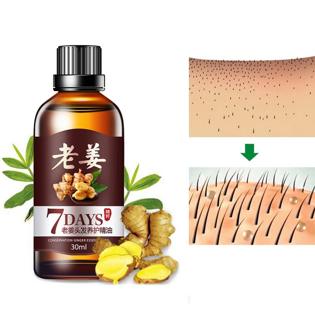 30ml Radish Hair Lotion Hair Essential Oil Hair Care Head Anti-Hair Loss Hair Growth Liquid Suitable For Dry And Damaged Hair
30ml Radish Hair Lotion Hair Essential Oil Hair Care Head Anti-Hair Loss Hair Growth Liquid Suitable For Dry And Damaged Hair