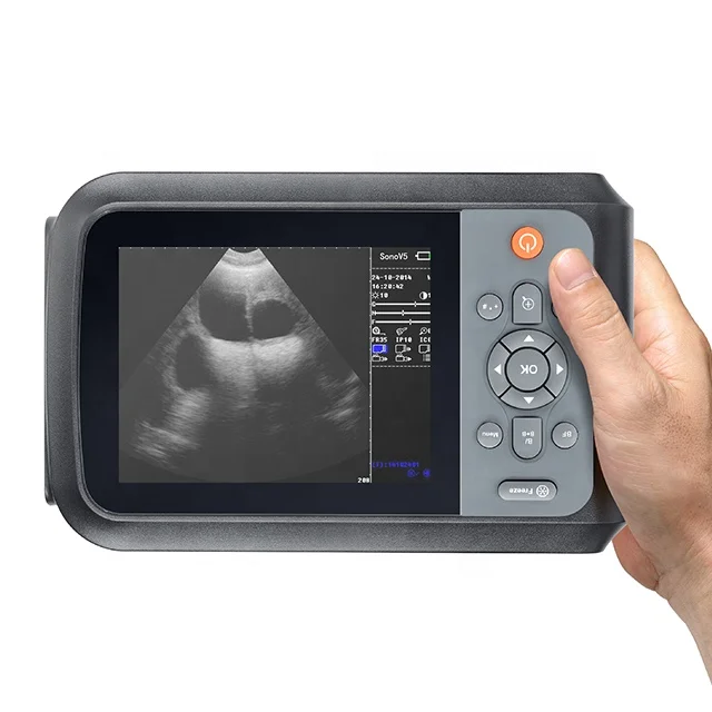 Medical Ultrasound Instruments Portable vet Machine portable Ultrasound Scanner 
Medical Ultrasound Instruments Portable vet Machine portable Ultrasound Scanner