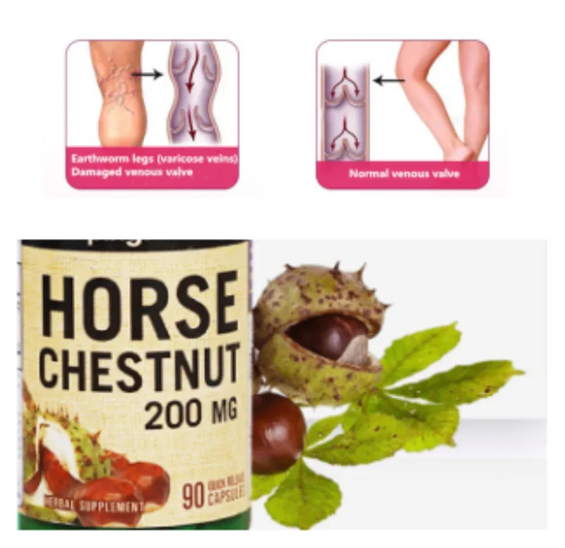 Horse chestnut seed extract improves leg muscle spasm to prevent varicose veins
Horse chestnut seed extract improves leg muscle spasm to prevent varicose veins