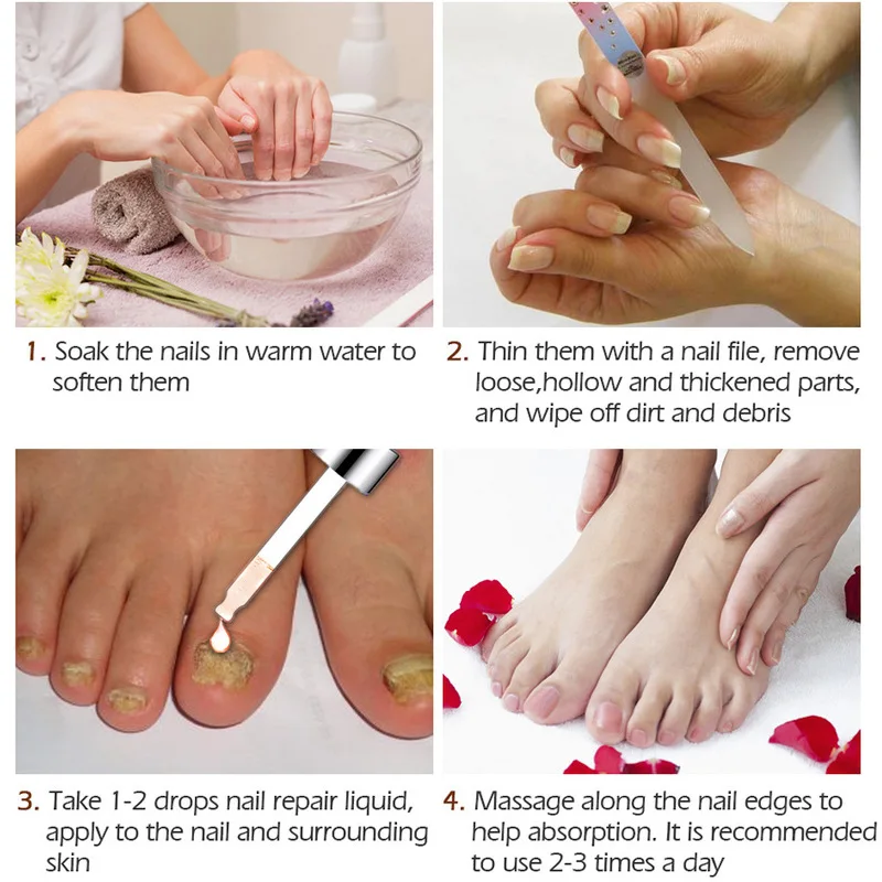 Nail Repair Serum Nail Treatment Essence Fungus Onychomycosis Removal Anti Fungus Nail Toe Nourishing Nail Care
Nail Repair Serum Nail Treatment Essence Fungus Onychomycosis Removal Anti Fungus Nail Toe Nourishing Nail Care