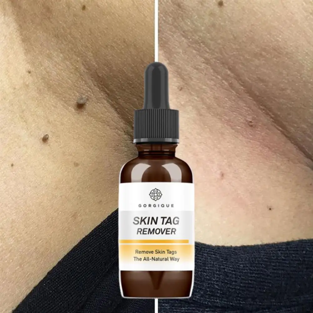 Effective Whitening Freckle Cream Remove Melasma Acne Spot Melanin Pigment Moisturizing Pigmentation Gel Care Dark Spots Sk O5I6
Effective Whitening Freckle Cream Remove Melasma Acne Spot Melanin Pigment Moisturizing Pigmentation Gel Care Dark Spots Sk O5I6