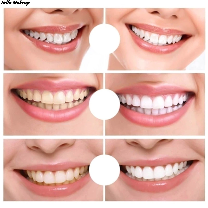 Teeth Whitening Pen Cleaning Serum Stains Remover Teeth Bleachment Dental Whitener Oral Hygiene Care Teeth White Wholesale
Teeth Whitening Pen Cleaning Serum Stains Remover Teeth Bleachment Dental Whitener Oral Hygiene Care Teeth White Wholesale