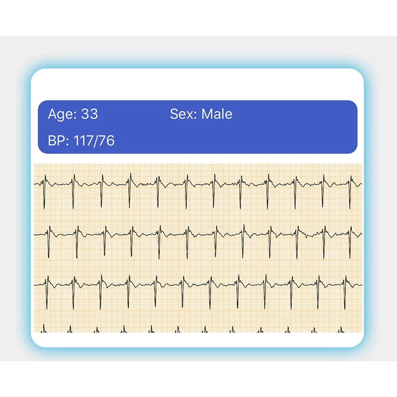 E80 Smart Watch Body Temperature Measurement PPG+ECG IP68 Waterproof Smart Watch
E80 Smart Watch Body Temperature Measurement PPG+ECG IP68 Waterproof Smart Watch