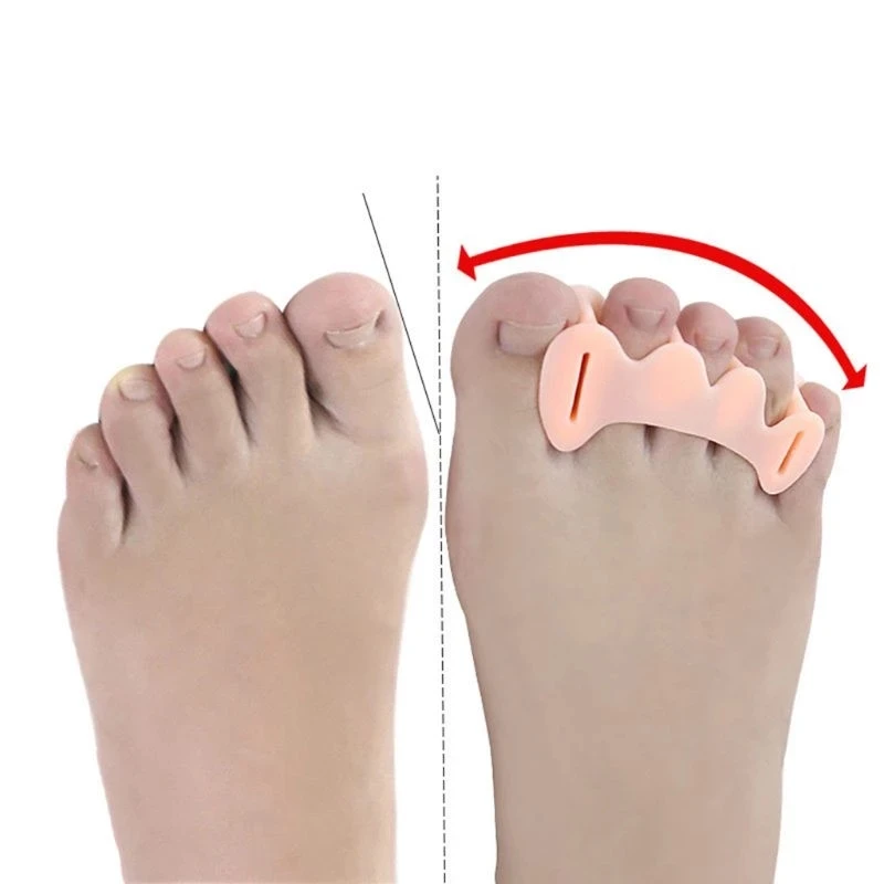 2pcs=1pair Silicone Toe Finger Separator 3 Hole Hallux Valgus Orthotics Bunion Care Overlapping Hammer Corrector Foot Care Tool
2pcs=1pair Silicone Toe Finger Separator 3 Hole Hallux Valgus Orthotics Bunion Care Overlapping Hammer Corrector Foot Care Tool
